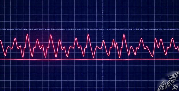 Un algoritmo que combina inteligencia artificial y electrocardiograma puede detectar la apnea obstructiva del sueño con precisión